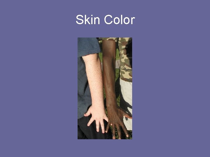Skin Color 