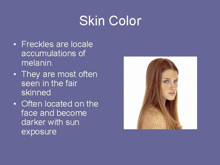 Skin Color • Freckles are locale accumulations of melanin. • They are most often