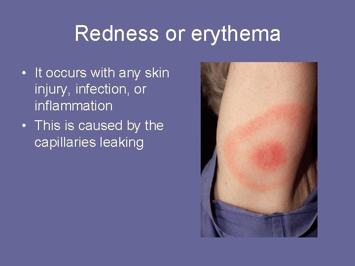 Redness or erythema • It occurs with any skin injury, infection, or inflammation •