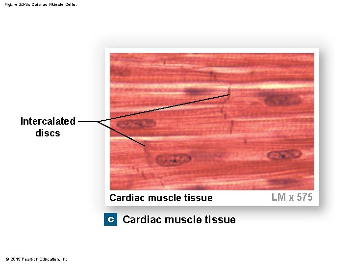 Figure 20 -5 c Cardiac Muscle Cells. Intercalated discs Cardiac muscle tissue c Cardiac