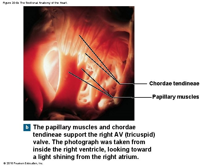 Figure 20 -6 b The Sectional Anatomy of the Heart. Chordae tendineae Papillary muscles