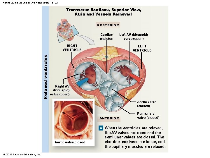 Figure 20 -8 a Valves of the Heart (Part 1 of 2). Transverse Sections,