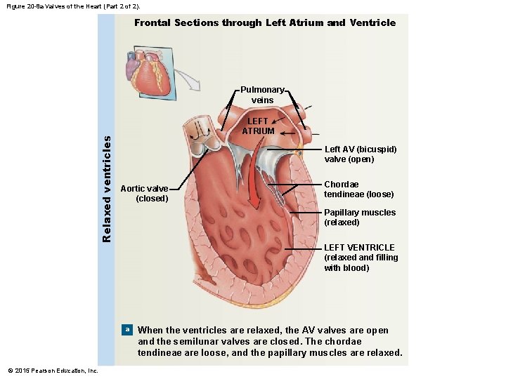 Figure 20 -8 a Valves of the Heart (Part 2 of 2). Frontal Sections