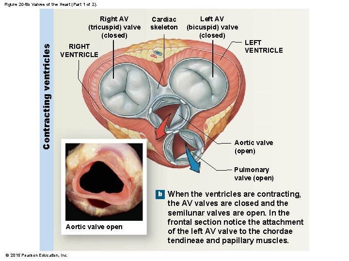 Figure 20 -8 b Valves of the Heart (Part 1 of 2). Contracting ventricles