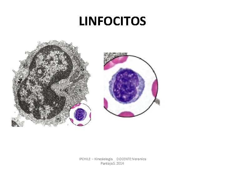 LINFOCITOS IPCHILE - Kinesiologia DOCENTE: Veronica Pantoja S. 2014 LINFOCITOS IPCHILE - Kinesiologia DOCENTE: Veronica Pantoja S. 2014