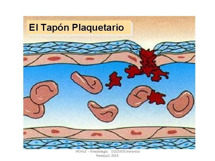 El Tapón Plaquetario IPCHILE - Kinesiologia DOCENTE: Veronica Pantoja S. 2014 El Tapón Plaquetario IPCHILE - Kinesiologia DOCENTE: Veronica Pantoja S. 2014