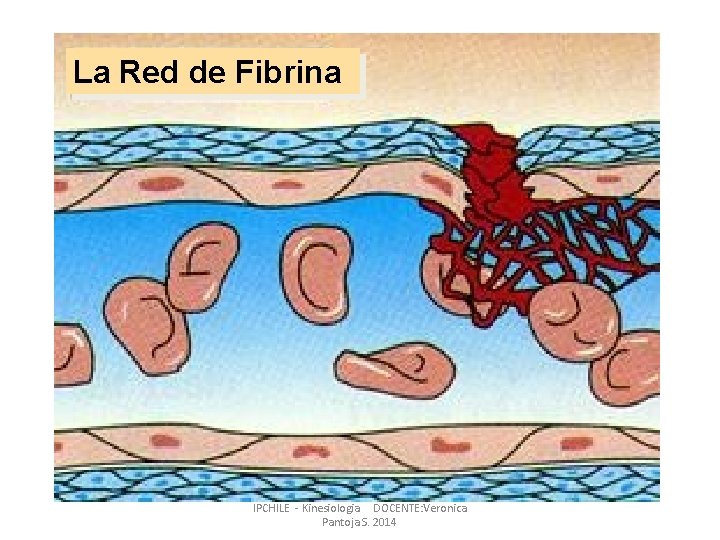 La Red de Fibrina IPCHILE - Kinesiologia DOCENTE: Veronica Pantoja S. 2014 La Red de Fibrina IPCHILE - Kinesiologia DOCENTE: Veronica Pantoja S. 2014