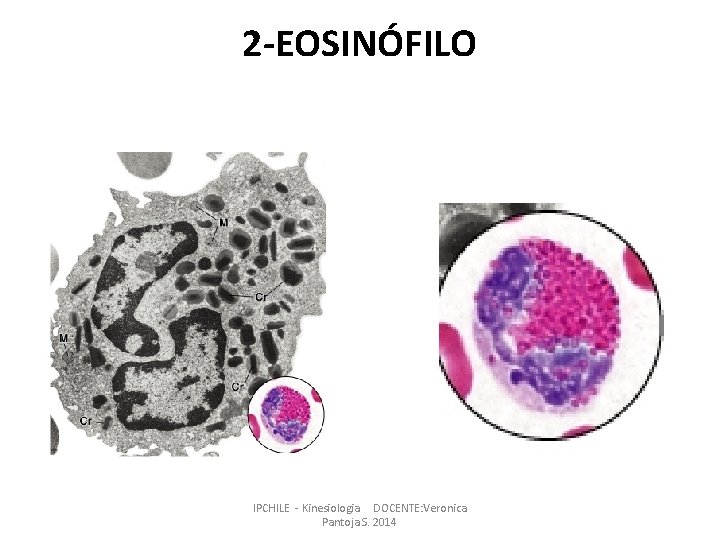 2 -EOSINÓFILO IPCHILE - Kinesiologia DOCENTE: Veronica Pantoja S. 2014 2 -EOSINÓFILO IPCHILE - Kinesiologia DOCENTE: Veronica Pantoja S. 2014