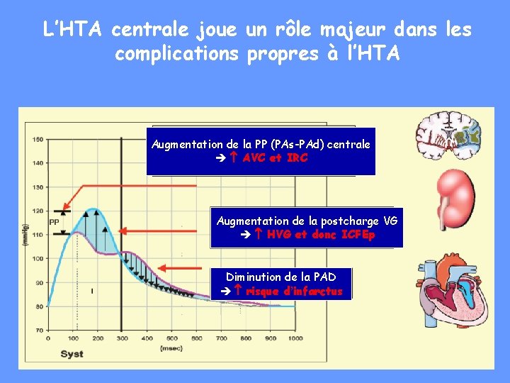 L’HTA centrale joue un rôle majeur dans les complications propres à l’HTA Augmentation de