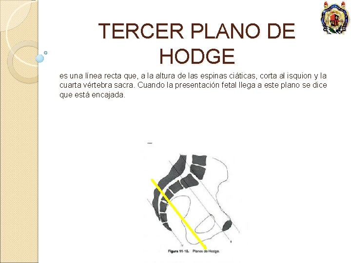 TERCER PLANO DE HODGE es una línea recta que, a la altura de las