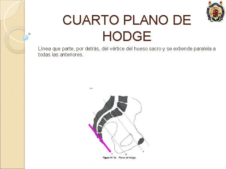 CUARTO PLANO DE HODGE Línea que parte, por detrás, del vértice del hueso sacro