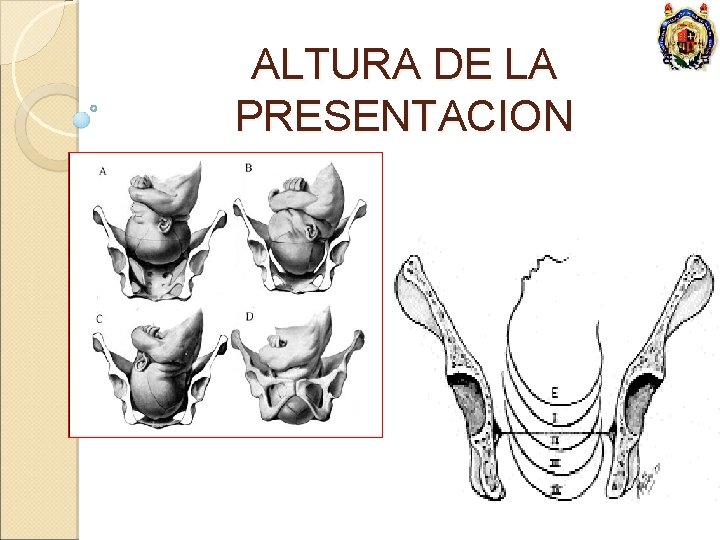 ALTURA DE LA PRESENTACION 