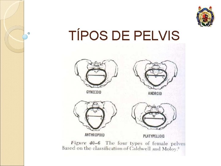 TÍPOS DE PELVIS 