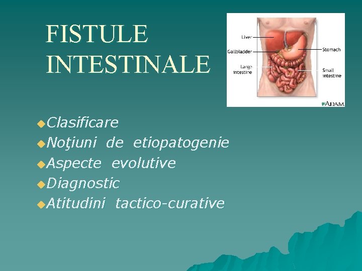 FISTULE INTESTINALE u. Clasificare u. Noţiuni de etiopatogenie u. Aspecte evolutive u. Diagnostic u.