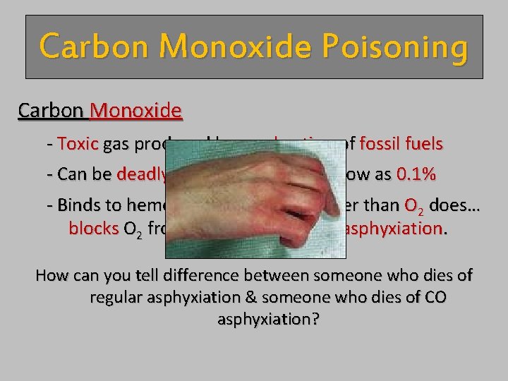 Carbon Monoxide Poisoning Carbon Monoxide - Toxic gas produced by combustion of fossil fuels