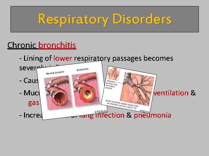 Respiratory Disorders Chronic bronchitis - Lining of lower respiratory passages becomes severely inflamed -