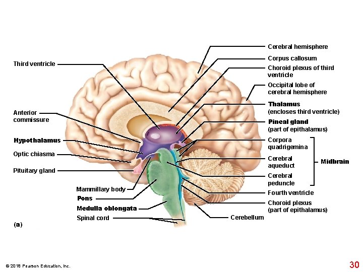Cerebral hemisphere Corpus callosum Third ventricle Choroid plexus of third ventricle Occipital lobe of