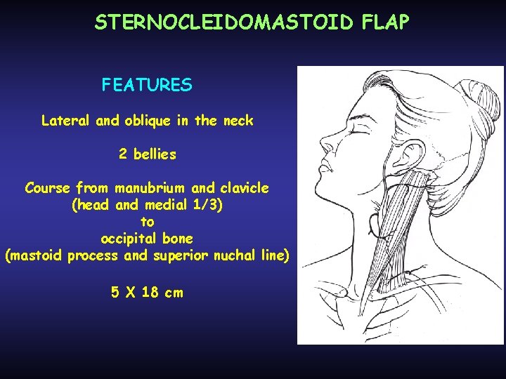 STERNOCLEIDOMASTOID FLAP FEATURES Lateral and oblique in the neck 2 bellies Course from manubrium