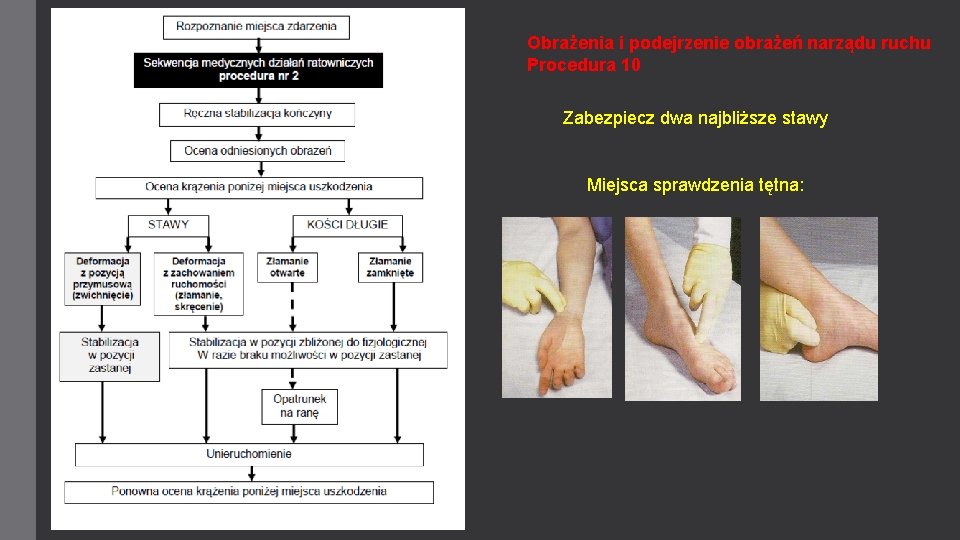 Obrażenia i podejrzenie obrażeń narządu ruchu Procedura 10 Zabezpiecz dwa najbliższe stawy Miejsca sprawdzenia