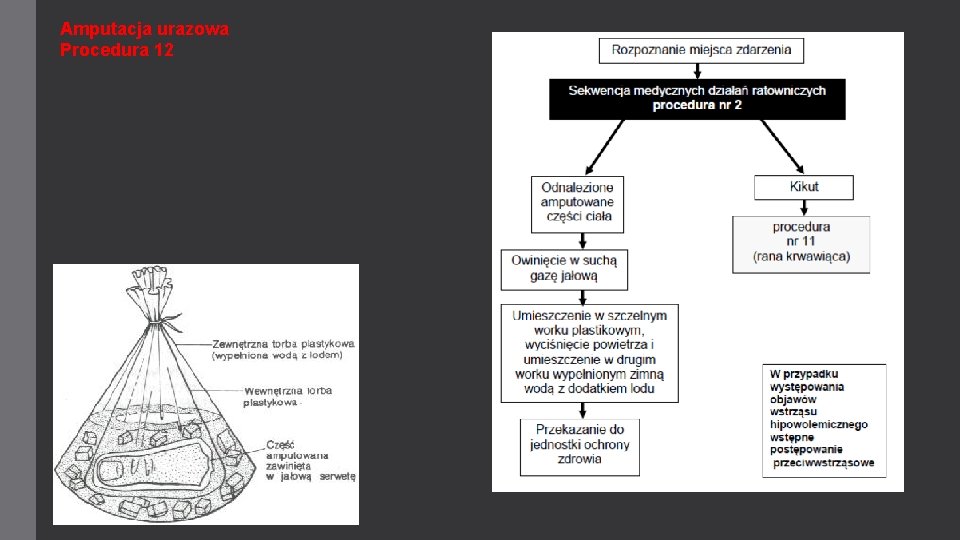 Amputacja urazowa Procedura 12 