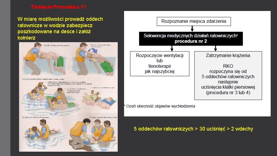 Tonięcie Procedura 17 W miarę możliwości prowadź oddech ratownicze w wodzie zabezpiecz poszkodowane na