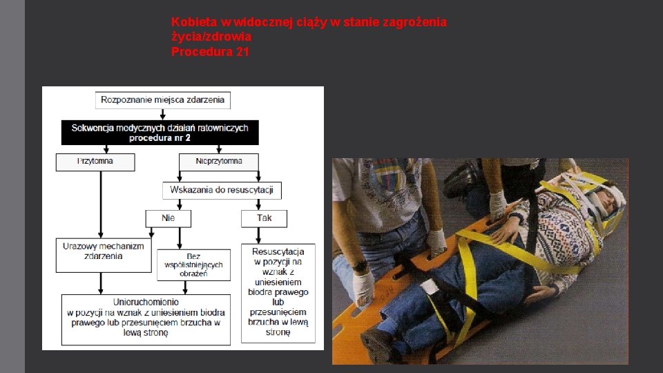 Kobieta w widocznej ciąży w stanie zagrożenia życia/zdrowia Procedura 21 