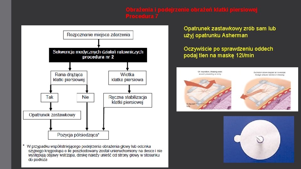 Obrażenia i podejrzenie obrażeń klatki piersiowej Procedura 7 Opatrunek zastawkowy zrób sam lub użyj