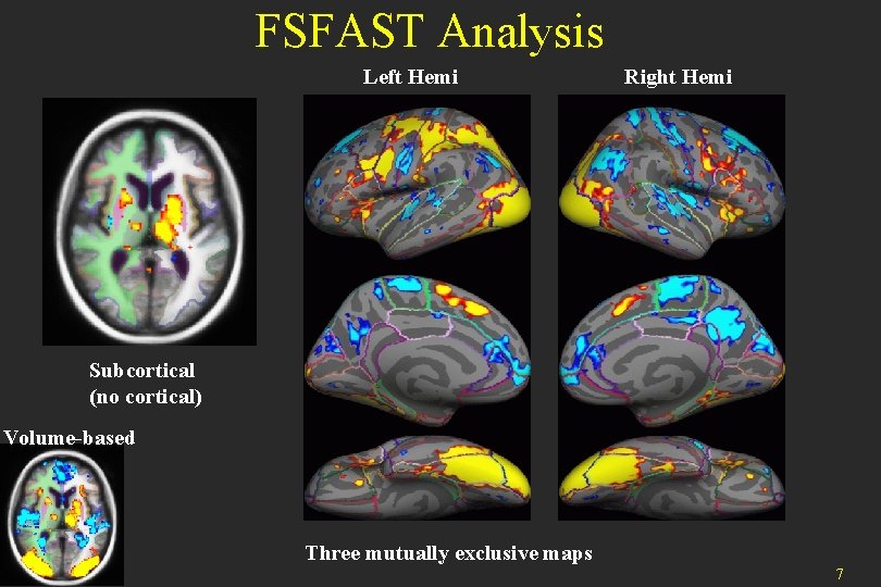 FSFAST Analysis Left Hemi Right Hemi Subcortical (no cortical) Volume-based Three mutually exclusive maps