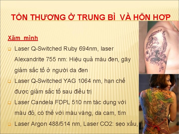 TỔN THƯƠNG Ở TRUNG BÌ VÀ HỖN HỢP Xăm mình q Laser Q-Switched Ruby