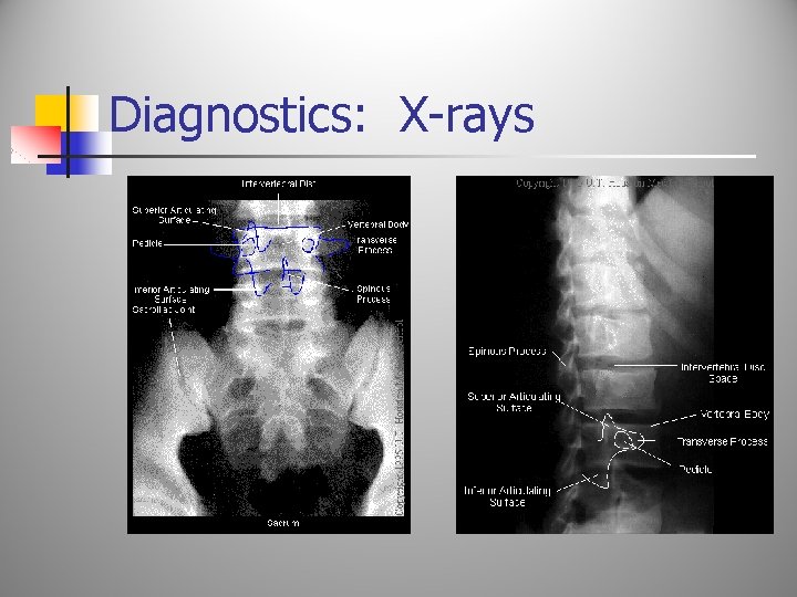 Diagnostics: X-rays 