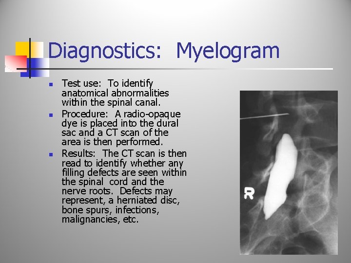 Diagnostics: Myelogram n n n Test use: To identify anatomical abnormalities within the spinal