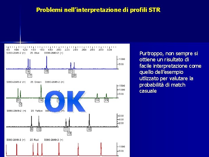 Problemi nell’interpretazione di profili STR OK Purtroppo, non sempre si ottiene un risultato di Problemi nell’interpretazione di profili STR OK Purtroppo, non sempre si ottiene un risultato di
