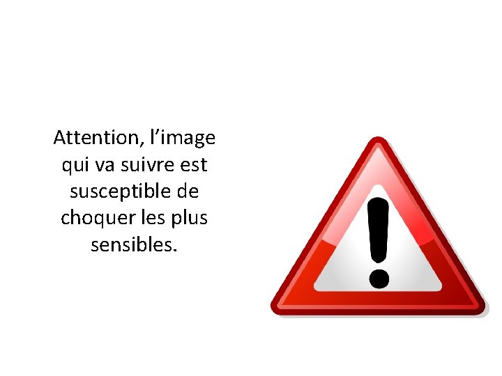 Attention, l’image qui va suivre est susceptible de choquer les plus sensibles. 