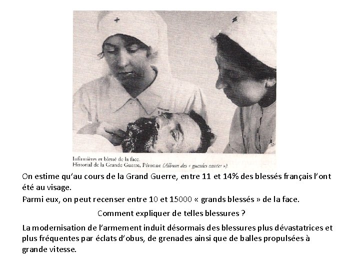 On estime qu’au cours de la Grand Guerre, entre 11 et 14% des blessés