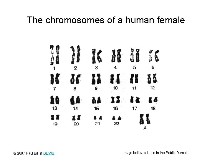 The chromosomes of a human female © 2007 Paul Billiet ODWS Image believed to