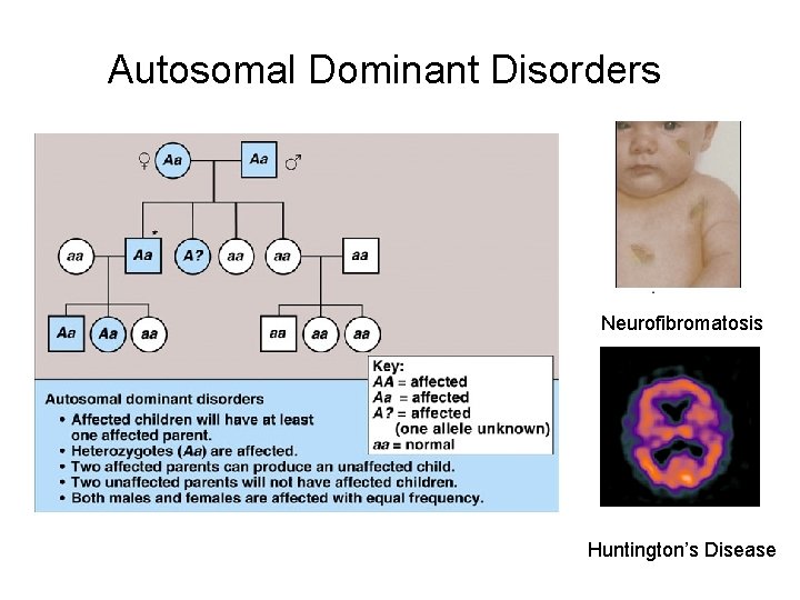 Autosomal Dominant Disorders Neurofibromatosis Huntington’s Disease 