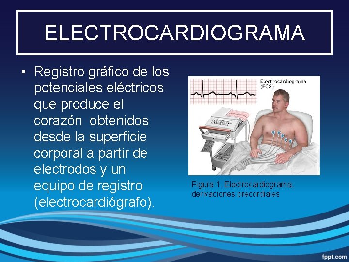 ELECTROCARDIOGRAMA • Registro gráfico de los potenciales eléctricos que produce el corazón obtenidos desde