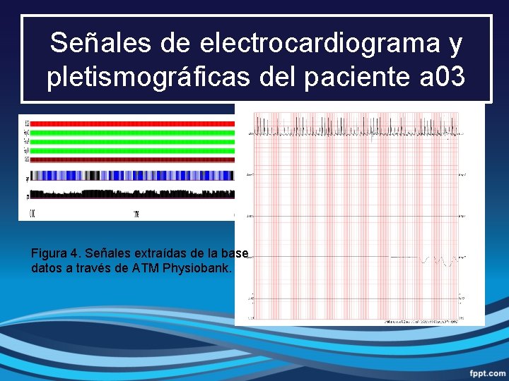 Señales de electrocardiograma y pletismográficas del paciente a 03 Figura 4. Señales extraídas de