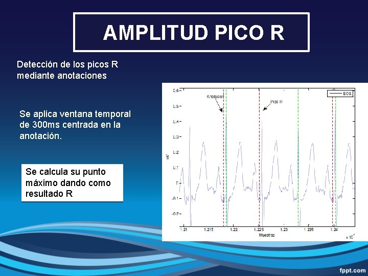  AMPLITUD PICO R Detección de los picos R mediante anotaciones Se aplica ventana