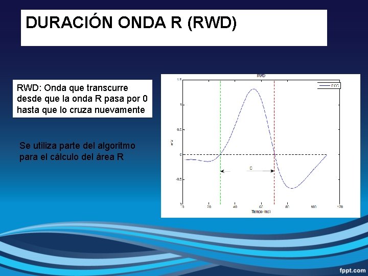 DURACIÓN ONDA R (RWD) RWD: Onda que transcurre desde que la onda R pasa