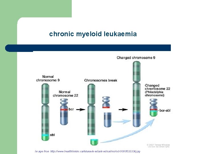 chronic myeloid leukaemia Image from http: //www. healthlinkbc. ca/kbase/media/medical/nci/cdr 0000533336. jpg 