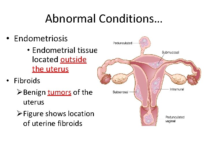 Abnormal Conditions… • Endometriosis • Endometrial tissue located outside the uterus • Fibroids ØBenign