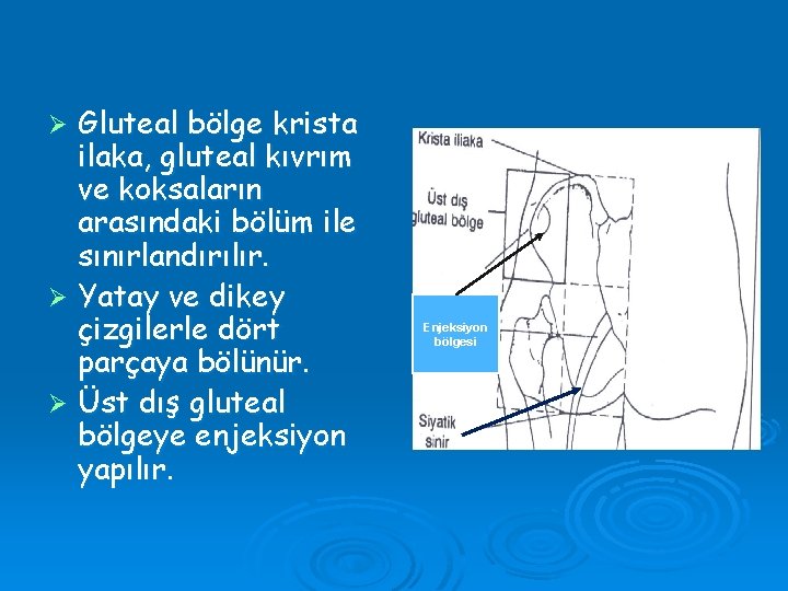 Gluteal bölge krista ilaka, gluteal kıvrım ve koksaların arasındaki bölüm ile sınırlandırılır. Ø Yatay