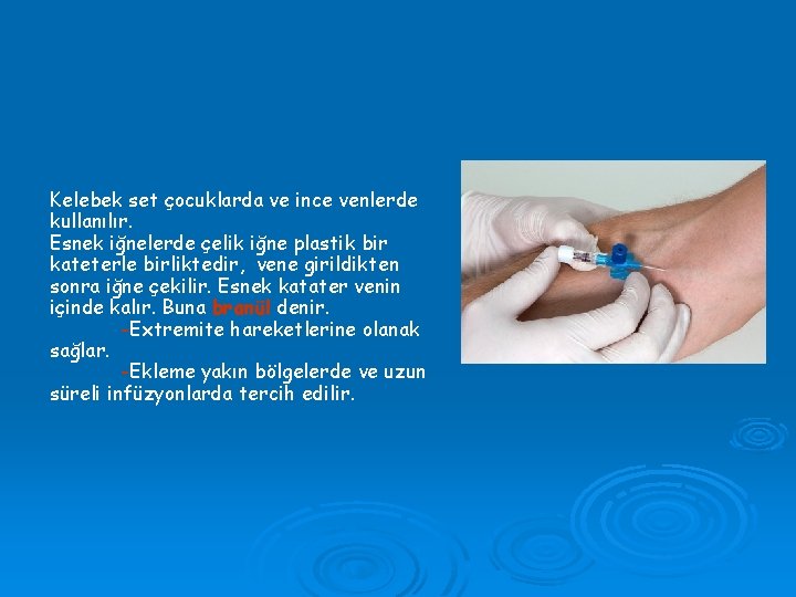 Kelebek set çocuklarda ve ince venlerde kullanılır. Esnek iğnelerde çelik iğne plastik bir kateterle