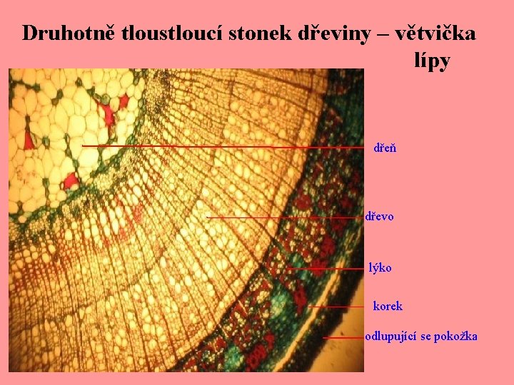 Druhotně tloustloucí stonek dřeviny – větvička lípy dřeň dřevo lýko korek odlupující se pokožka