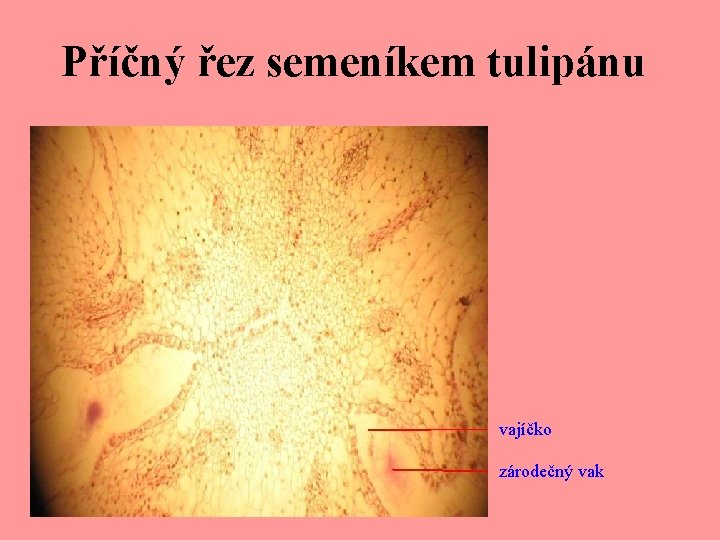 Příčný řez semeníkem tulipánu vajíčko zárodečný vak 