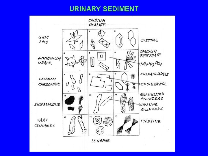 URINARY SEDIMENT 