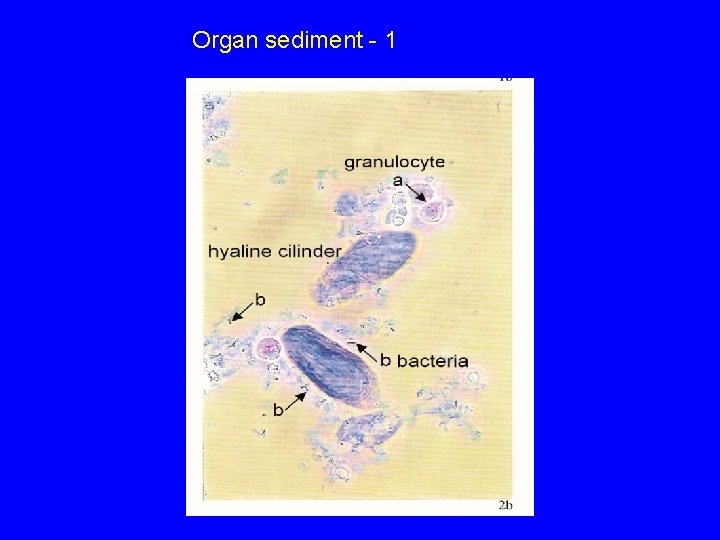 Organ sediment - 1 