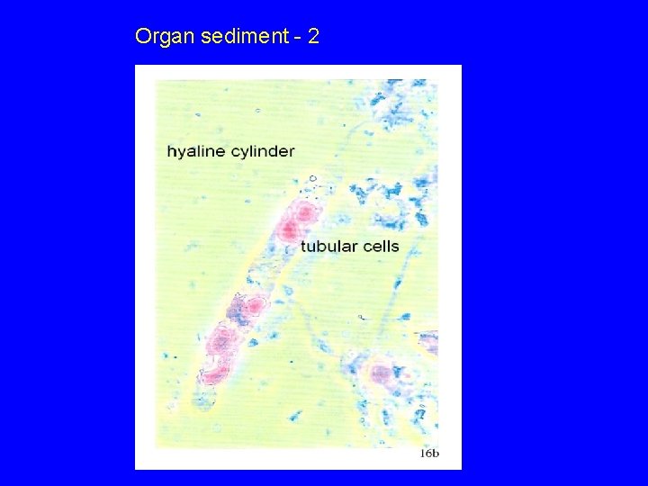 Organ sediment - 2 