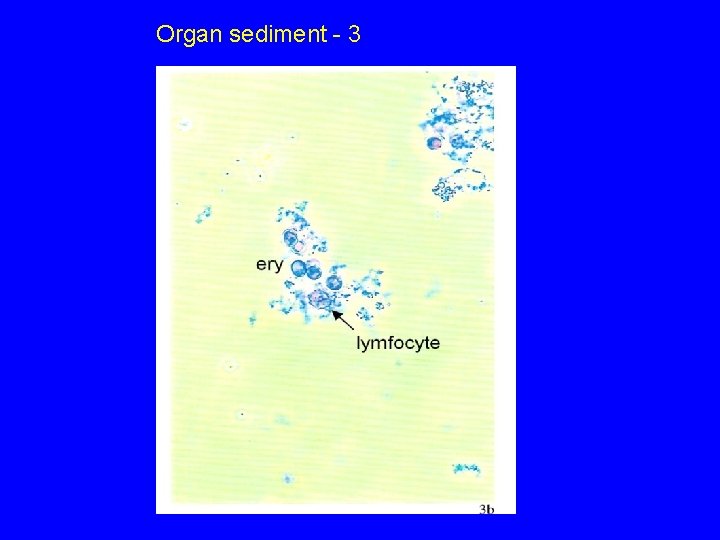 Organ sediment - 3 